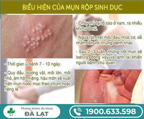 Hình ảnh minh họa
